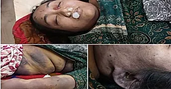గాంధీధామ్‌లో నేపాల్ మహిళ హత్య కలకలం