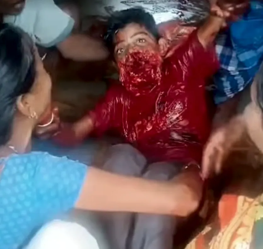 కొమరం భీం జిల్లాలో విషాదం… చిన్న బ్యాటరీ పేలి బాలుడు మృతి