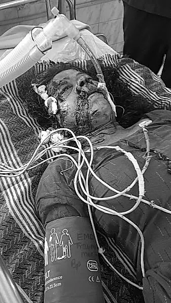 తిరుపతిలో భార్యపై భర్త హత్యాయత్నం