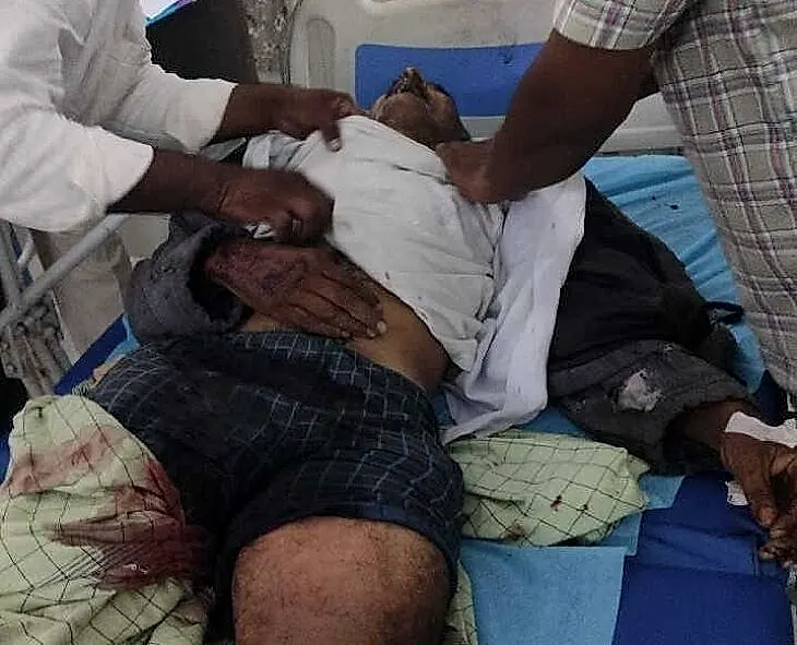 బద్వేల్‌లో ఘోర రోడ్డు ప్రమాదం: ఇద్దరు మృతి, లారీ డ్రైవర్‌కు తీవ్ర గాయాలు