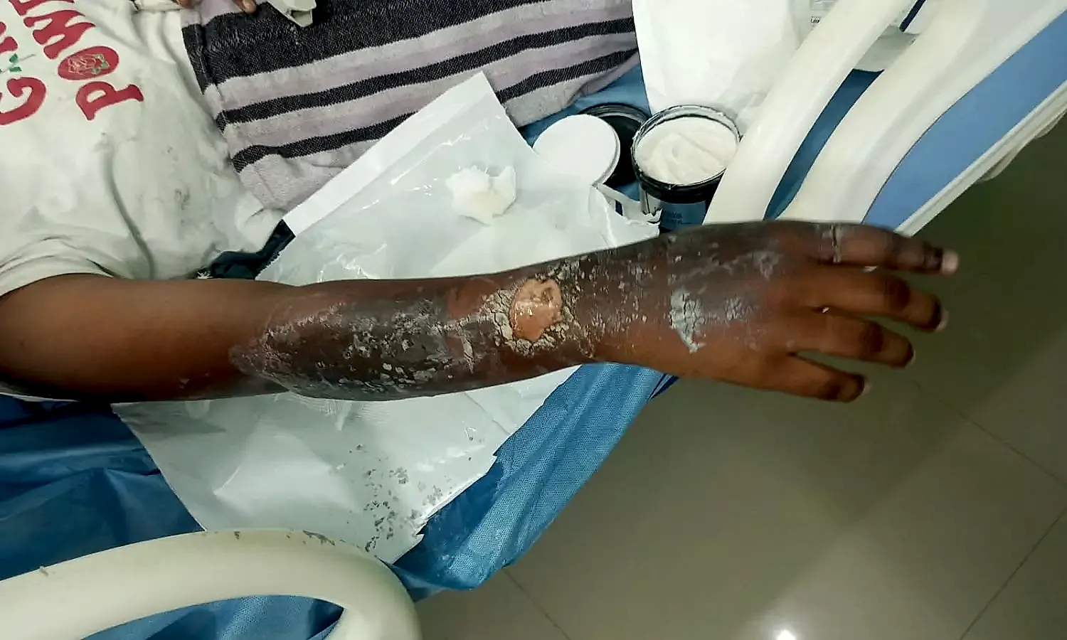 నిమ్మనపల్లె మోడల్ స్కూల్‌లో విద్యార్థినికి కరెంట్ షాక్‌