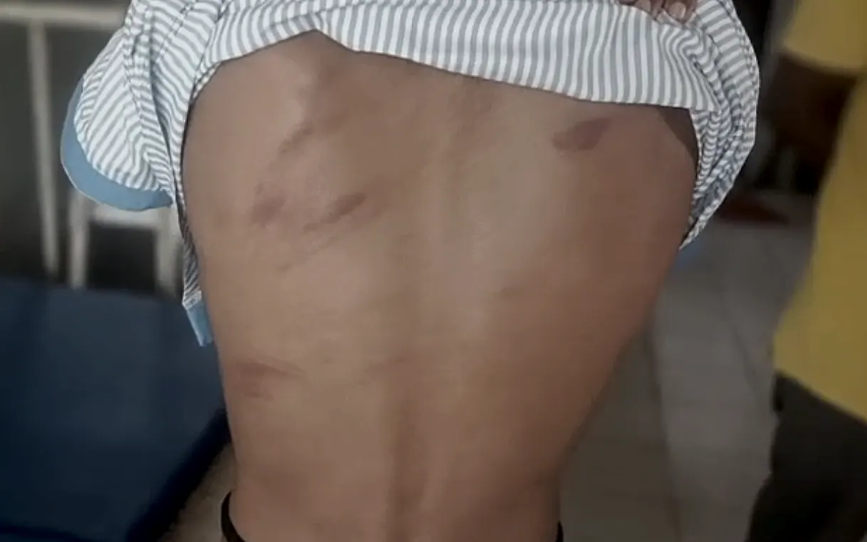 ప్రొద్దుటూరులో ప్రైవేట్ స్కూల్లో విద్యార్థిని చితకబాదిన టీచర్..