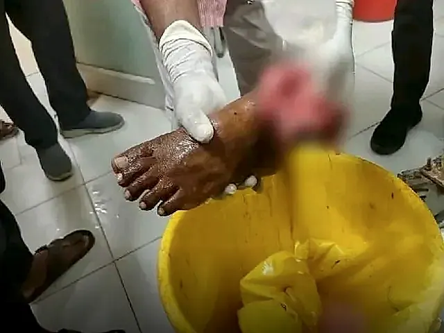 ఆదోని శివారులో బోలేరో ఢీకొని ఎద్దుల బండి ప్రమాదం… ఇద్దరికి తీవ్ర గాయాలు