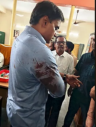 వైసీపీ ఎంపీ మిథున్‌ రెడ్డి కాన్వాయ్‌పై దాడి, పలువురికి గాయాలు